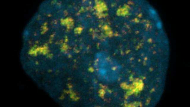 Neurons exposed to Ara-C chemotherapy trigger a DNA damage response at enhancers, marked by foci of gamma-H2AX (red) colocalizing with 53BP1 (green). 